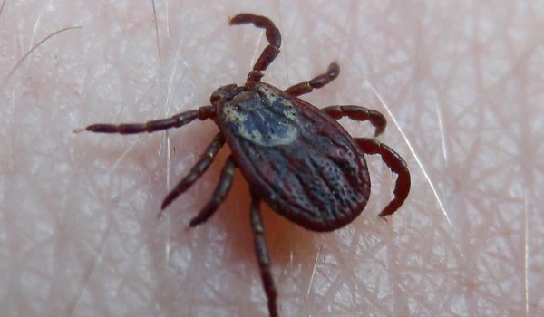 Близък план на кучешки кърлеж (Rhipicephalus sanguineus), кацнал върху човешка кожа – основен преносител на марсилска треска