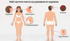 места по тялото където хапят кърлежи. 